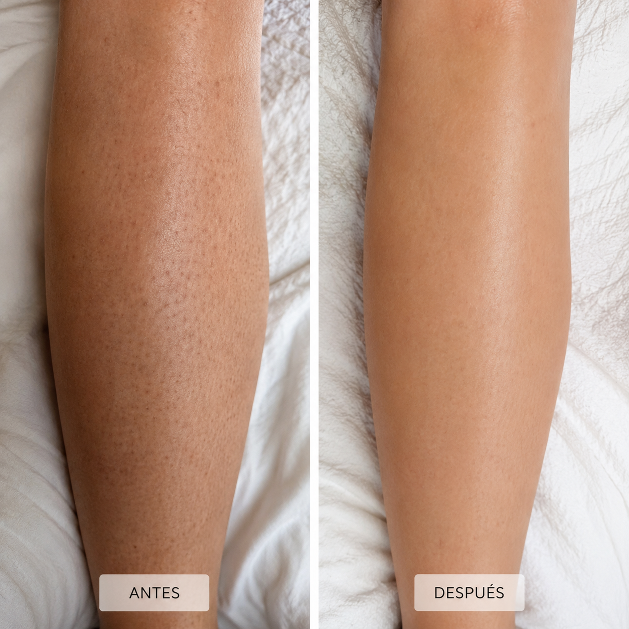 Retinol Renewal