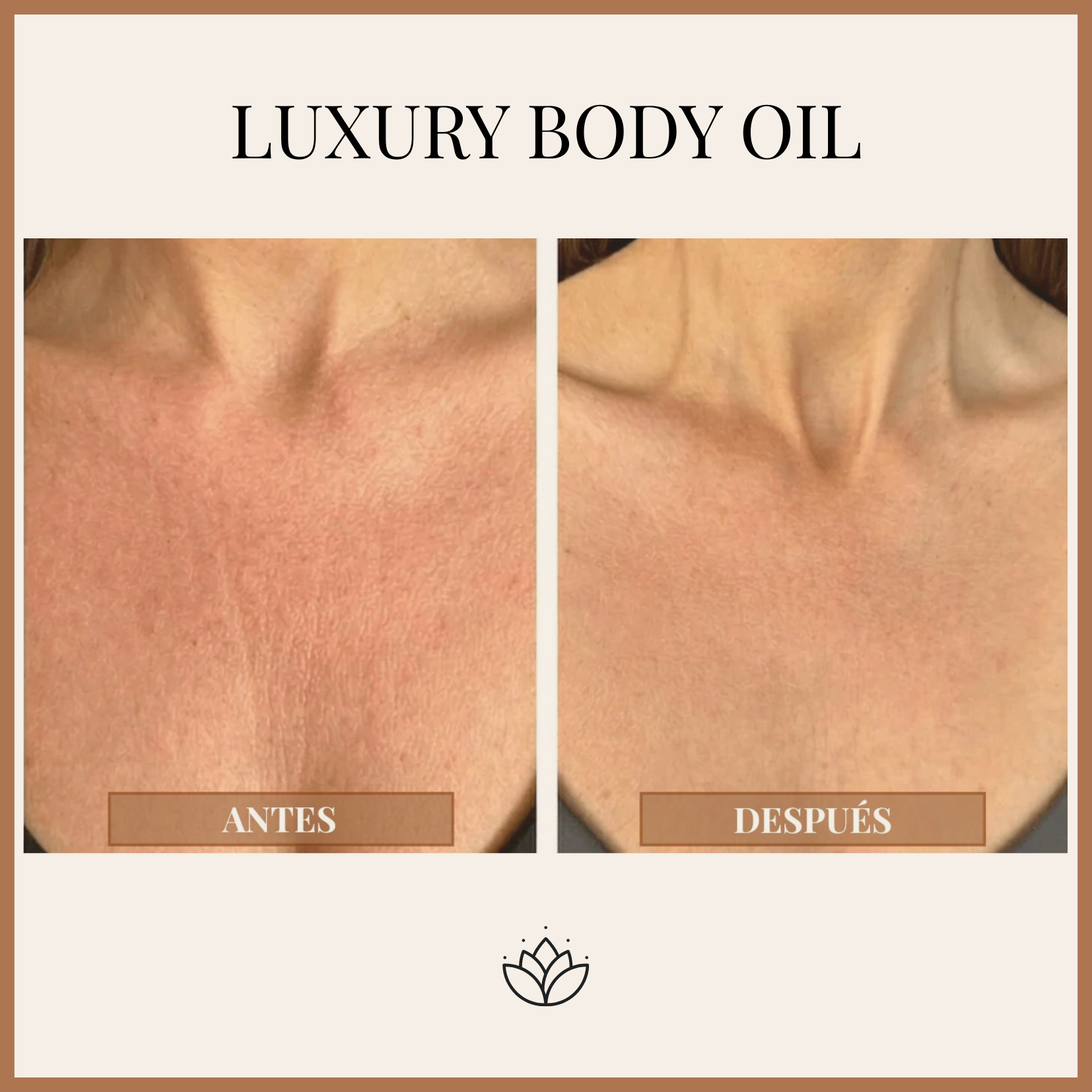 Luxury Body Oil — Firme, Suave y Radiante