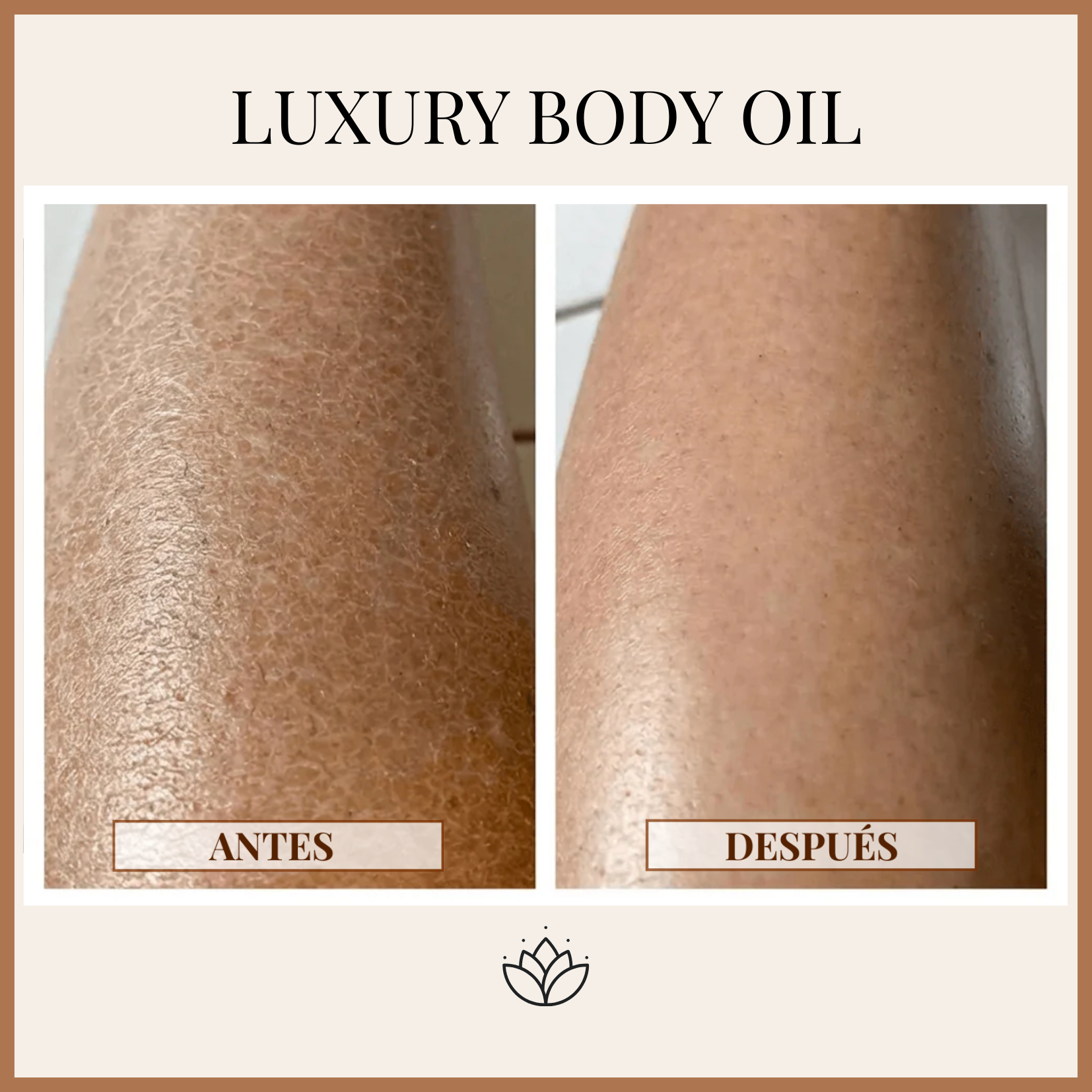 Luxury Body Oil — Firme, Suave y Radiante